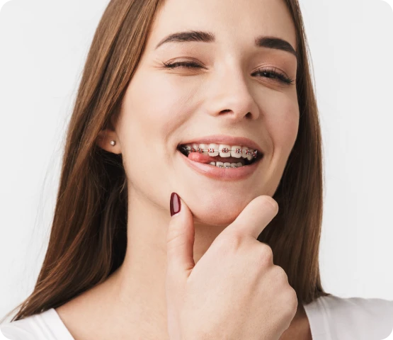 Jeune femme souriante avec un appareil dentaire
